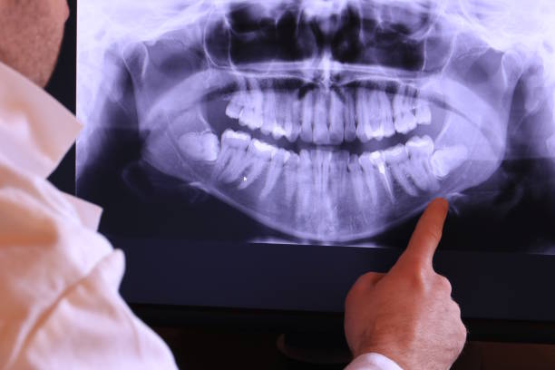 Best Root Canal Emergency Dentist  in Radford, VA